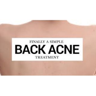 [Celines Beauty ] 1-Hour Back Acne Treatment