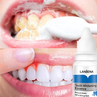 Plaque cleaning tooth washing powder to remove yellow teeth and whiten whitening artifact oral bacteriostatic 10ml (1)
