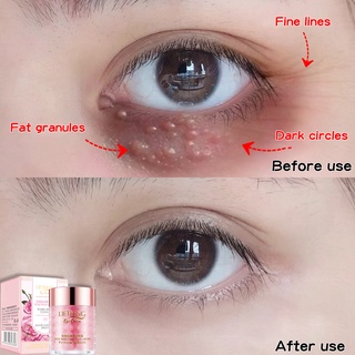 Eye cream Eye cream serum Dark circles eye cream 60g Moisturizing Anti aging treatment wrinkle Eye bag Fat granules 眼霜