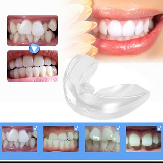 【RM9 free ship 】Original Teeth Orthodontic Alignment Adult Tooth Trainer