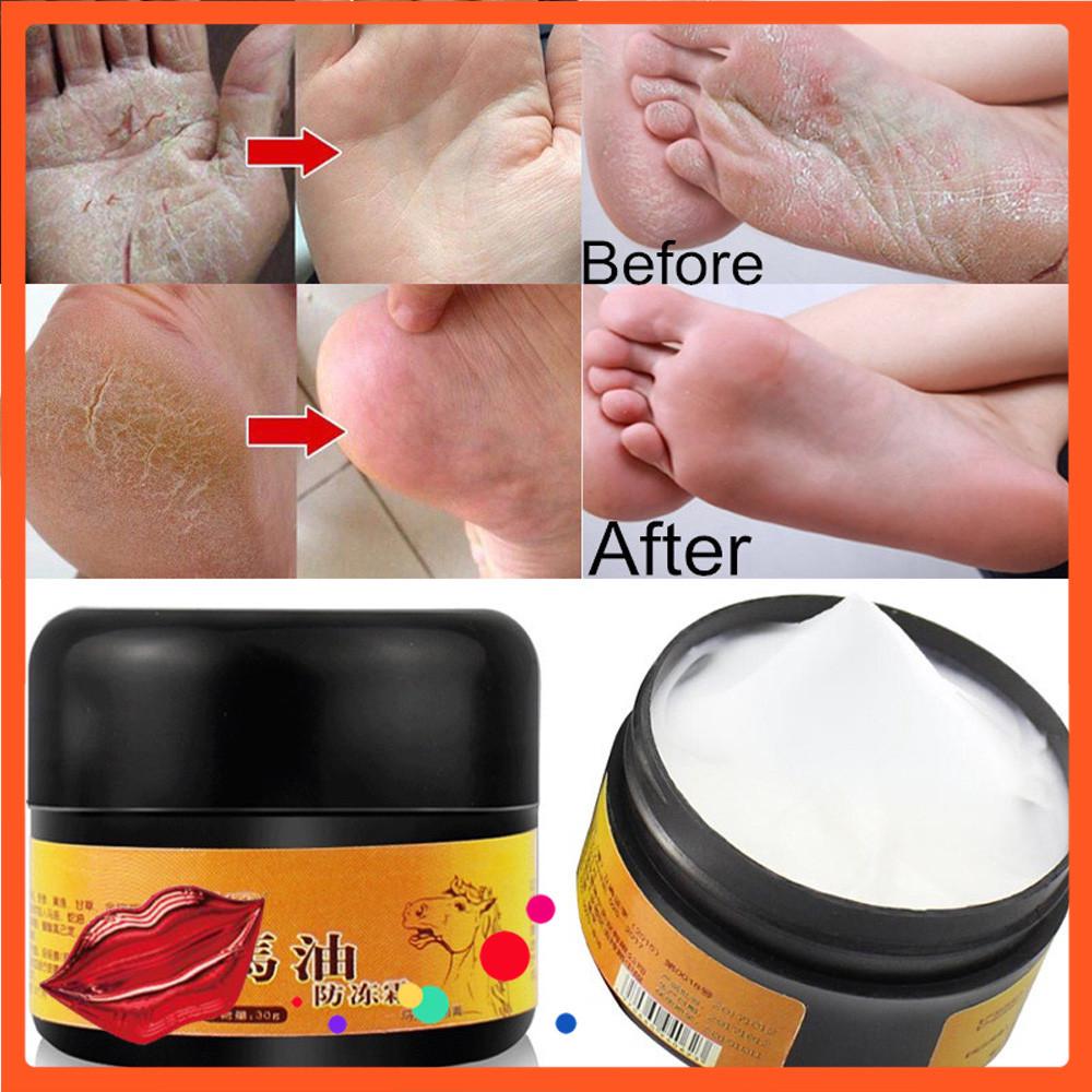😊😋Horse Oil Feet Cream Care Foot Itch Blisters Peeling Bad Feet Ointment