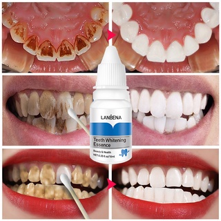【Local stock】Pemutih Gigi, Teeth Whitening BUANG KARANG PLAK GIGI Oral Hygiene tooth