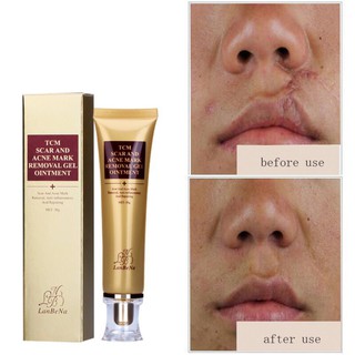 BT-LANBENA Acne scars remove acne Remove scar cream