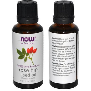 100% Pure Rosehip Seed Oil, Made in USA (30ml)